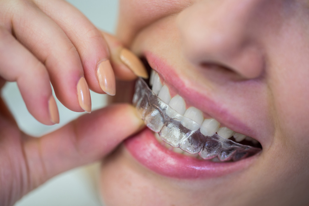 Orthodontic Treatments in Bhubaneswar: Straightening Your Smile