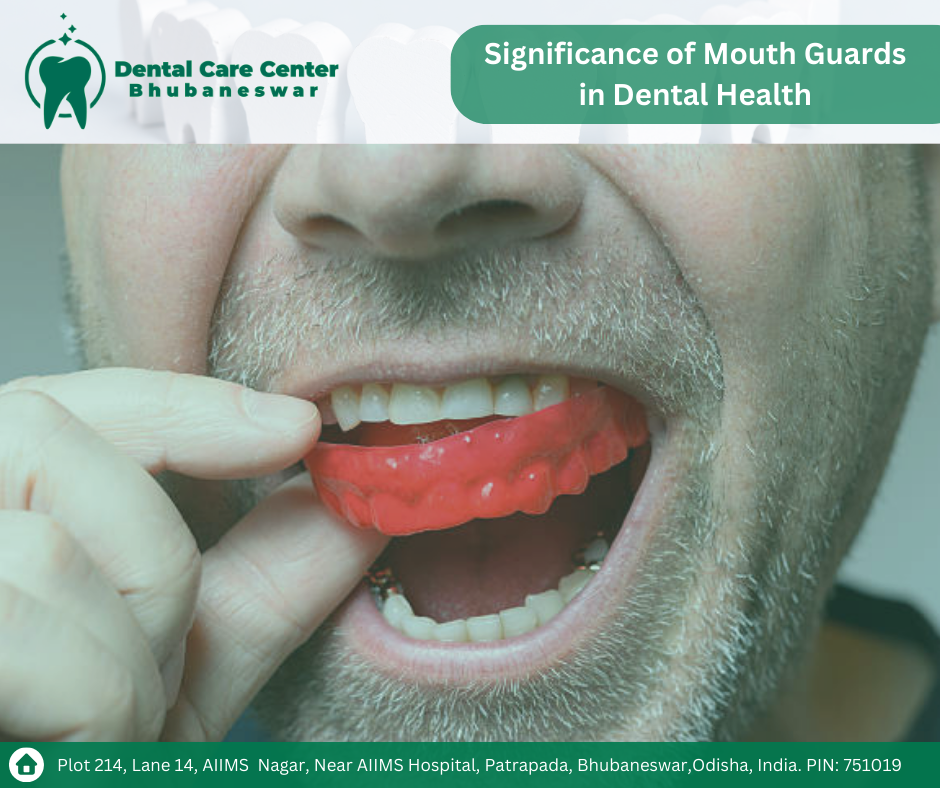 Safeguarding Your Smile: Exploring the Significance of Mouth Guards in Dental Health