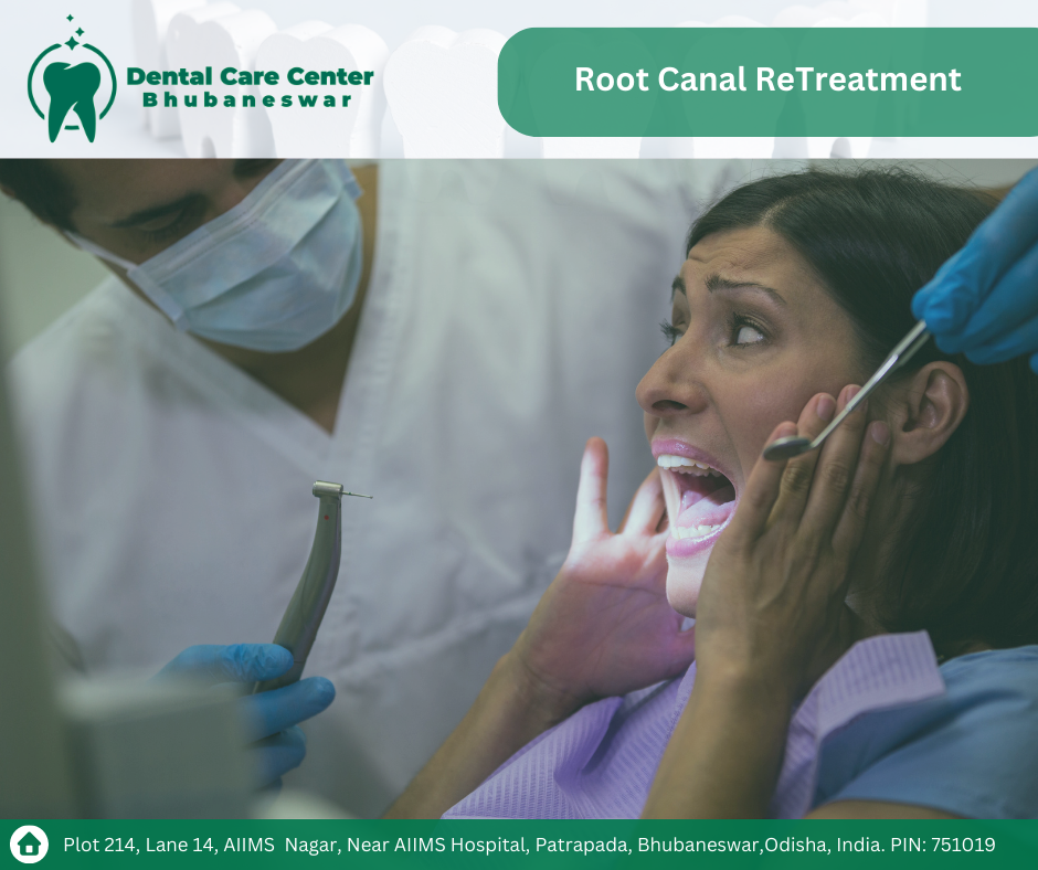 Unlocking the Secrets of Root Canal Retreatment in Bhubaneswar: A Comprehensive Overview